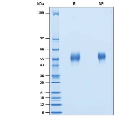 2 μg/lane of Recombinant Mouse IL1RAPL1 His-tag (Catalog # 10757-MR) was resolved with SDS-PAGE under reducing (R) and non-reducing (NR) conditions and visualized by Coomassie® Blue staining, showing bands at 52-58 kDa.