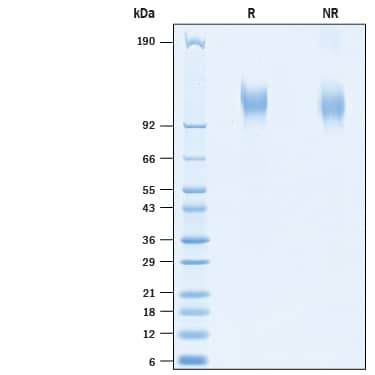 2 μg/lane of Recombinant SARS-CoV-2 20A.EU1 S1 Subunit His-tag (Catalog # 10768-CV) was resolved with SDS-PAGE under reducing (R) and non-reducing (NR) conditions and visualized by Coomassie® Blue staining, showing bands at 105-119 kDa.