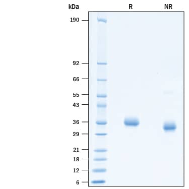 2 μg/lane of Recombinant SARS-CoV-2 P.1 Spike RBD His-tag (Catalog # 10775-CV) was resolved with SDS-PAGE under reducing (R) and non-reducing (NR) conditions and visualized by Coomassie® Blue staining, showing bands at 32-40 kDa.