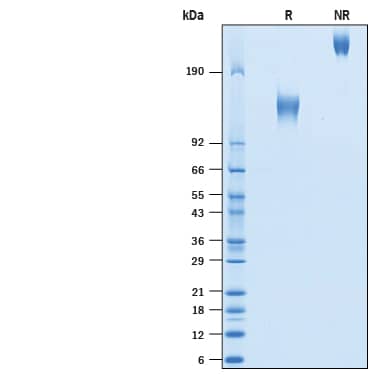 2 μg/lane of Recombinant SARS-CoV Spike S1 Subunit His-tag (Catalog # 10783-CV) was resolved with SDS-PAGE under reducing (R) and non-reducing (NR) conditions and visualized by Coomassie® Blue staining, showing bands at 116-128 kDa and 220-250 kDa, respectively.