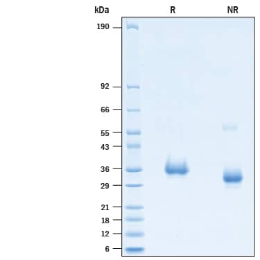 2 μg/lane of Recombinant SARS-CoV-2 Q493K Spike RBD His-tag (Catalog # 10791-CV) was resolved with SDS-PAGE under reducing (R) and non-reducing (NR) conditions and visualized by Coomassie® Blue staining, showing bands at 31-38 kDa.