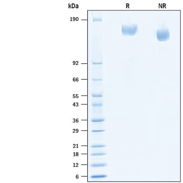 2 μg/lane of Recombinant SARS-CoV-2 B.1.525 Spike GCN4-IZ His-tag (Catalog # 10794-CV) was resolved with SDS-PAGE under reducing (R) and non-reducing (NR) conditions and visualized by Coomassie® Blue staining, showing bands at 140-170 kDa.