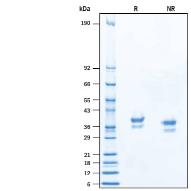 2 μg/lane of Recombinant Human VSIG3 His-tag (Catalog # 10806-VS) was resolved with SDS-PAGE under reducing (R) and non-reducing (NR) conditions and visualized by Coomassie® Blue staining, showing bands at 32-41 kDa.