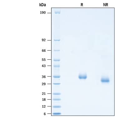 2 μg/lane of Recombinant SARS-CoV-2 Y489K Spike RBD His-tag (Catalog # 10811-CV) was resolved with SDS-PAGE under reducing (R) and non-reducing (NR) conditions and visualized by Coomassie® Blue staining, showing bands at 26-38 kDa.