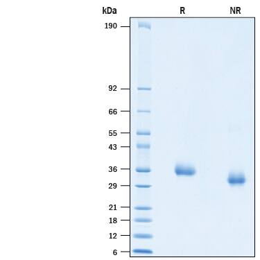 2 μg/lane of Recombinant SARS-CoV-2 F490S Spike RBD His-tag (Catalog # 10815-CV) was resolved with SDS-PAGE under reducing (R) and non-reducing (NR) conditions and visualized by Coomassie® Blue staining, showing bands at 26-38 kDa.