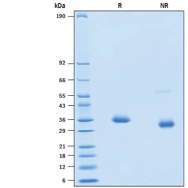 2 μg/lane of Recombinant SARS-CoV-2 K417E Spike RBD His-tag Protein (Catalog # 10816-CV) was resolved with SDS-PAGE under reducing (R) and non-reducing (NR) conditions and visualized by Coomassie® Blue staining, showing bands at 33-39 kDa.