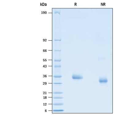 2 μg/lane of Recombinant SARS-CoV-2 L455F Spike RBD His-tag Protein (Catalog # 10817-CV) was resolved with SDS-PAGE under reducing (R) and non-reducing (NR) conditions and visualized by Coomassie® Blue staining, showing bands at 31-38 kDa.