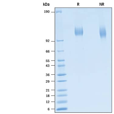 2 μg/lane of Recombinant SARS-CoV-2 B.1.2  S1 Subunit His-tag Protein (Catalog # 10822-CV) was resolved with SDS-PAGE under reducing (R) and non-reducing (NR) conditions and visualized by Coomassie® Blue staining, showing bands at 105-118 kDa.