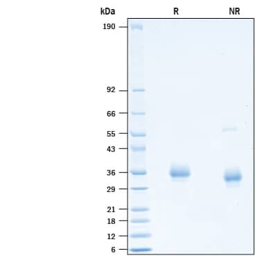 2 μg/lane of Recombinant SARS-CoV-2 V367F E484K Spike RBD His-tag (Catalog # 10825-CV) was resolved with SDS-PAGE under reducing (R) and non-reducing (NR) conditions and visualized by Coomassie® Blue staining, showing bands at 30-37 kDa.