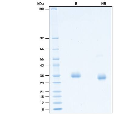 2 μg/lane of Recombinant SARS-CoV-2 B.1.324.1 Spike RBD His-tag Protein (Catalog # 10830-CV) was resolved with SDS-PAGE under reducing (R) and non-reducing (NR) conditions and visualized by Coomassie® Blue staining, showing bands at 33-40 kDa.