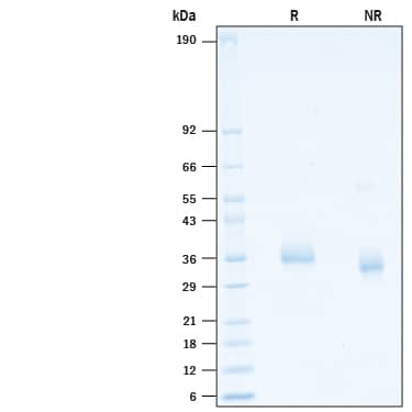 2 μg/lane of Recombinant SARS-CoV-2 B.1.617 Spike RBD His-tag (Catalog # 10846-CV) was resolved with SDS-PAGE under reducing (R) and non-reducing (NR) conditions and visualized by Coomassie® Blue staining, showing bands at 31-38 kDa.