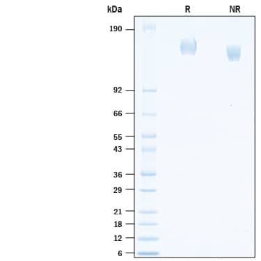 2 μg/lane of Recombinant SARS-CoV-2 B.1.526 Spike (GCN4-IZ) His-tag Protein (Catalog # 10848-CV) was resolved with SDS-PAGE under reducing (R) and non-reducing (NR) conditions and visualized by Coomassie® Blue staining, showing bands at 145-165 kDa.