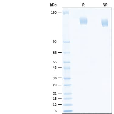 2 μg/lane of Recombinant SARS-CoV-2 CAL.20C Spike (GCN4-IZ) His-tag (Catalog # 10849-CV) was resolved with SDS-PAGE under reducing (R) and non-reducing (NR) conditions and visualized by Coomassie® Blue staining, showing bands at 145-165 kDa.