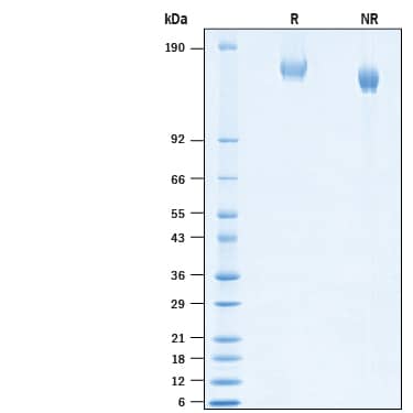 2 μg/lane of Recombinant SARS-CoV-2 B.1.1.318 Spike (GCN4-IZ) His-tag Protein (Catalog # 10856-CV) was resolved with SDS-PAGE under reducing (R) and non-reducing (NR) conditions and visualized by Coomassie® Blue staining, showing bands at 145-165 kDa.