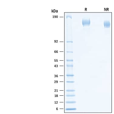 2 μg/lane of Recombinant SARS-CoV-2 B.1.526 Spike GCN4-IZ His-tag Protein (Catalog # 10874-CV) was resolved with SDS-PAGE under reducing (R) and non-reducing (NR) conditions and visualized by Coomassie® Blue staining, showing bands at 145-165 kDa.
