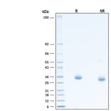 2 μg/lane of Recombinant SARS-CoV-2 T478K Spike RBD His-tag (Catalog # 10875-CV) was resolved with SDS-PAGE under reducing (R) and non-reducing (NR) conditions and visualized by Coomassie® Blue staining, showing bands at 30-38 kDa.