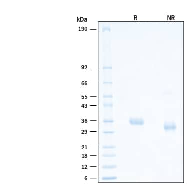 2 μg/lane of Recombinant SARS-CoV-2 C.37 Spike RBD His-tag Protein (Catalog # 10880-CV) was resolved with SDS-PAGE under reducing (R) and non-reducing (NR) conditions and visualized by Coomassie® Blue staining, showing bands at 32-38 kDa.