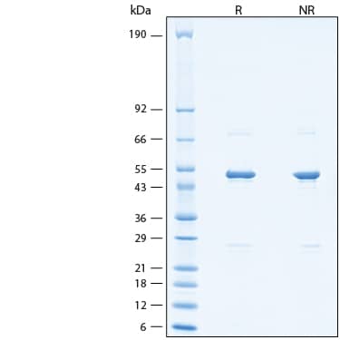 2 μg/lane of Recombinant SARS-CoV Nucleocapsid His-tag Protein (Catalog # 10898-CV) was resolved with SDS-PAGE under reducing (R) and non-reducing (NR) conditions and visualized by Coomassie® Blue staining, showing bands at 47-53 kDa.