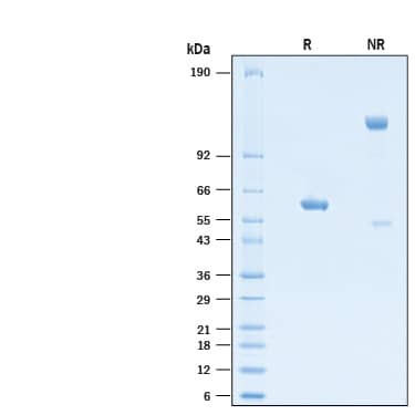 2 μg/lane of Recombinant SARS-CoV-2 P.1 Spike RBD Fc Chimera Protein (Catalog # 10914-CV) was resolved with SDS-PAGE under reducing (R) and non-reducing (NR) conditions and visualized by Coomassie® Blue staining, showing bands at 57-64 kDa and 110-130 kDa, respectively.