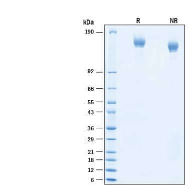2 μg/lane of Recombinant SARS-CoV-2 B.1.620 Spike (GCN4-IZ) His-tag Protein (Catalog # 10917-CV) was resolved with SDS-PAGE under reducing (R) and non-reducing (NR) conditions and visualized by Coomassie® Blue staining, showing bands at 150-170 kDa.