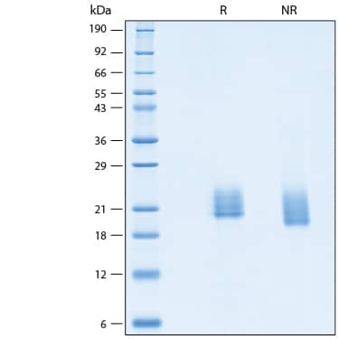 2 μg/lane of Recombinant SARS-CoV-2 ORF8 His-tag Protein (Catalog # 10918-CV) was resolved with SDS-PAGE under reducing (R) and non-reducing (NR) conditions and visualized by Coomassie® Blue staining, showing bands at 18-24 kDa.