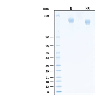 2 μg/lane of Recombinant SARS-CoV-2 AY.1 Spike (GCN4-IZ) His-tag Protein (Catalog # 10922-CV) was resolved with SDS-PAGE under reducing (R) and non-reducing (NR) conditions and visualized by Coomassie® Blue staining, showing bands at 142-170 kDa.