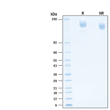 2 μg/lane of Recombinant SARS-CoV-2 AY.2 Spike (GCN4-IZ) His-tag Protein (Catalog # 10923-CV) was resolved with SDS-PAGE under reducing (R) and non-reducing (NR) conditions and visualized by Coomassie® Blue staining, showing bands at 142-170 kDa.