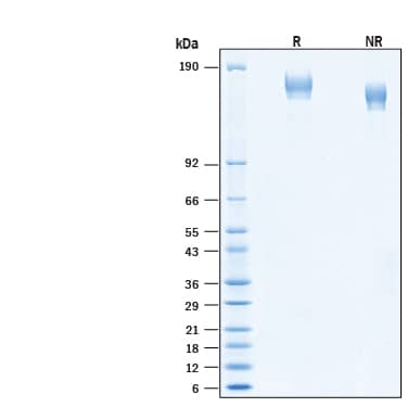 2 μg/lane of Recombinant SARS-CoV-2 B.1.616 Spike (GCN4-IZ) His-tag (Catalog # 10933-CV)  was resolved with SDS-PAGE under reducing (R) and non-reducing (NR) conditions and visualized by Coomassie® Blue staining, showing bands at 150-170 kDa.