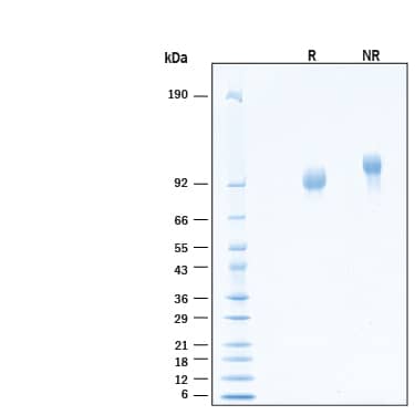 2 μg/lane of Recombinant Human Serpin G1 His-tag Protein (Catalog # 10951-PI) was resolved with SDS-PAGE under reducing (R) and non-reducing (NR) conditions and visualized by Coomassie® Blue staining, showing bands at 89-98 kDa.