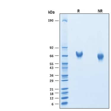 2 μg/lane of Recombinant Mouse CEACAM-20 His-tag Protein (Catalog # 10953-CM) was resolved with SDS-PAGE under reducing (R) and non-reducing (NR) conditions and visualized by Coomassie® Blue staining, showing bands at 63-73 kDa.