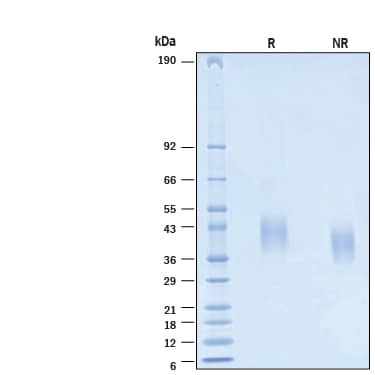 2 μg/lane of Recombinant Human TSLPR His-tag Protein (Catalog # 10963-TR) was resolved with SDS-PAGE under reducing (R) and non-reducing (NR) conditions and visualized by Coomassie® Blue staining, showing bands at 37-47 kDa.