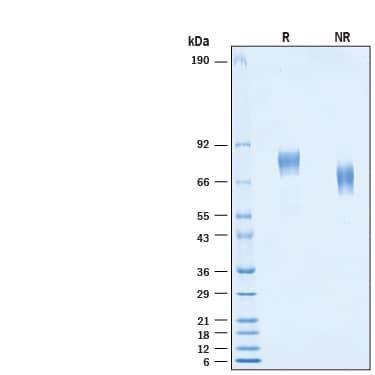 2 μg/lane of Recombinant Influenza A Virus H1N1 Hemagglutinin His-tag Protein (Catalog # 10973-HA) was resolved with SDS-PAGE under reducing (R) and non-reducing (NR) conditions and visualized by Coomassie® Blue staining, showing bands at 68-83 kDa.