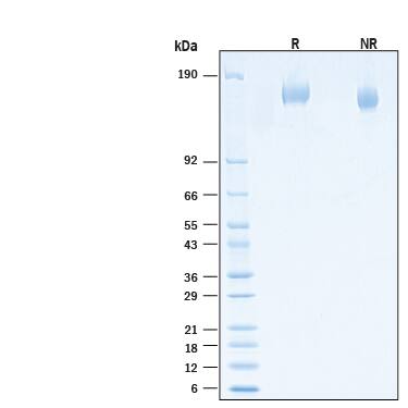 2 μg/lane of Recombinant SARS-CoV-2 B.1.617.1 Spike His-tag Protein  (Catalog # 10978-CV) was resolved with SDS-PAGE under reducing (R) and non-reducing (NR) conditions and visualized byCoomassie® Blue staining, showing bands at 150-170 kDa.