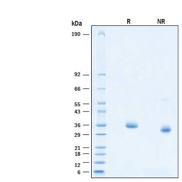 2 μg/lane of Recombinant SARS-CoV-2 B.1.621 K417N Spike RBD Histag (Catalog # 10981-CV) was resolved with SDS-PAGE under reducing (R) and non-reducing (NR) conditions and visualized by Coomassie® Blue staining, showing bands at 32-38 kDa.