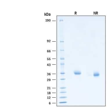 2 μg/lane of Recombinant SARS-CoV-2 B.1.617.2 G446V S RBD His Protein (Catalog # 10982-CV) was resolved with SDS-PAGE under reducing (R) and non-reducing (NR) conditions and visualized by Coomassie® Blue staining, showing bands at 34-38 kDa.