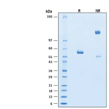 2 μg/lane of Recombinant SARS-CoV-2 B.1.617.2 G446V Spike RBD Fc Chimera (Catalog # 10983-CV) was resolved with SDS-PAGE under reducing (R) and non-reducing (NR) conditions and visualized by Coomassie® Blue staining, showing bands at 57-63 kDa and 110-130 kDa, respectively.