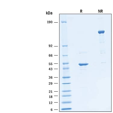 2 μg/lane of Recombinant SARS-CoV-2 B.1.617.2 Nucleocapsid His-tag Protein (Catalog # 10999-CV) was resolved with SDS-PAGE under reducing (R) and non-reducing (NR) conditions and visualized by Coomassie® Blue staining, showing bands at 45-55 kDa under reducing condition.
