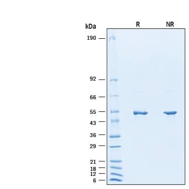 2 μg/lane of Recombinant SARS-CoV-2 B.1.2 N His-tag Protein (Catalog # 11000-CV) was resolved with SDS-PAGE under reducing (R) and non-reducing (NR) conditions and visualized by Coomassie® Blue staining, showing bands at 45-55 kDa.