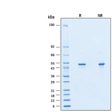 2 μg/lane of Recombinant SARS-CoV-2 B.1.1.7 Nucleocapsid His-tag Protein (Catalog # 11001-CV) was resolved with SDS-PAGE under reducing (R) and non-reducing (NR) conditions and visualized by Coomassie® Blue staining, showing bands at 48-54 kDa.