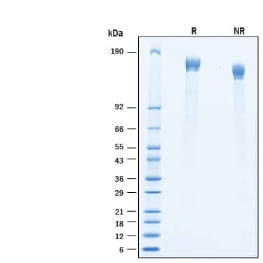 2 μg/lane of Recombinant SARS-CoV-2 C.1.2 Spike (GCN4-IZ) His-tag Protein (Catalog # 11007-CV) was resolved with SDS-PAGE under reducing (R) and non-reducing (NR) conditions and visualized by Coomassie® Blue staining, showing bands at 142-170 kDa.