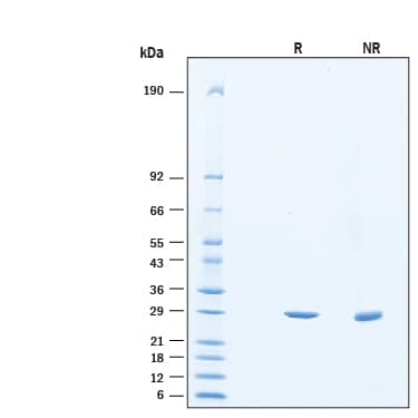 2 μg/lane of Recombinant Human TIGAR/C12orf5 His-tag Protein (Catalog # 11008-TG) was resolved with SDS-PAGE under reducing (R) and non-reducing (NR) conditions and visualized by Coomassie® Blue staining, showing bands at 27-30 kDa.