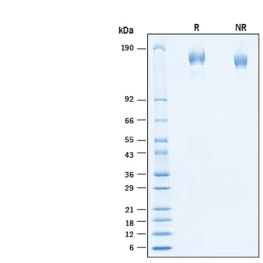 2 μg/lane of Recombinant SARS-CoV-2 R.1 S (GCN4-IZ) His-tag Protein (Catalog # 11026-CV) was resolved with SDS-PAGE under reducing (R) and non-reducing (NR) conditions and visualized by Coomassie® Blue staining, showing bands at 154-174 kDa.