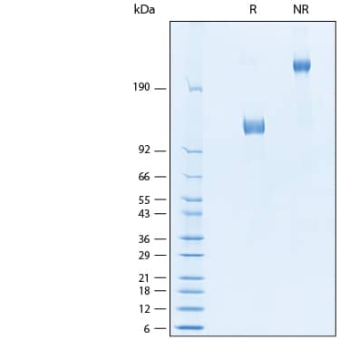 2 μg/lane of Recombinant Human IL-31RA Fc Chimera Protein (Catalog # 11028-IL) was resolved with SDS-PAGE under reducing (R) and non-reducing (NR) conditions and visualized by Coomassie® Blue staining, showing bands at 114-131 kDa and 130-160 kDa, respectively.