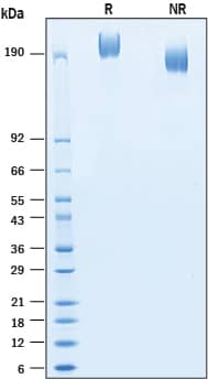 2 μg/lane of Recombinant Human DMBT1 His-tag Protein (Catalog # 11032-DB) was resolved with SDS-PAGE under reducing (R) and non-reducing (NR) conditions and visualized by Coomassie® Blue staining, showing bands at 225-285 kDa.