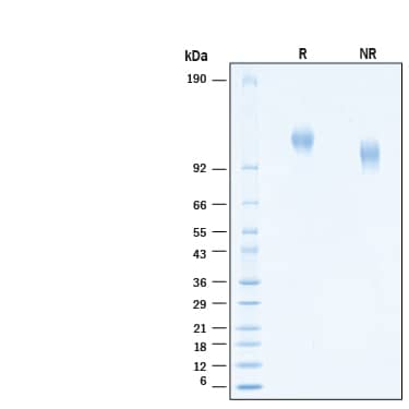 2 μg/lane of Recombinant Human P-Selectin/CD62P His-tag Protein (Catalog # 11035-PS) was resolved with SDS-PAGE under reducing (R) and non-reducing (NR) conditions and visualized by Coomassie® Blue staining, showing bands at 105-125- kDa.