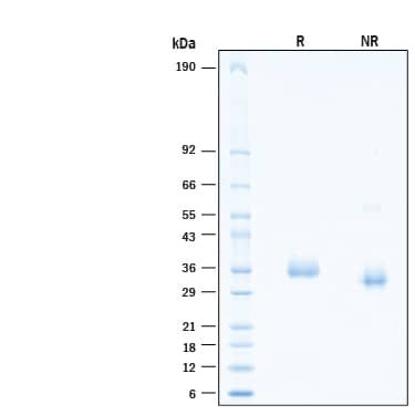 2 μg/lane of Recombinant SARS-CoV-2 P.1.8 Spike RBD His-tag Protein (Catalog # 11036-CV) was resolved with SDS-PAGE under reducing (R) and non-reducing (NR) conditions and visualized by Coomassie® Blue staining, showing bands at 30 - 40 kDa.