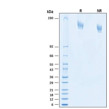 2 μg/lane of Recombinant SARS-CoV-2 P.1.8 Spike (GCN4-IZ) His Protein (Catalog # 11046-CV) was resolved with SDS-PAGE under reducing (R) and non-reducing (NR) conditions and visualized by Coomassie® Blue staining, showing bands at 145 - 170 kDa.