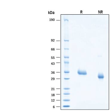 2 μg/lane of Recombinant SARS-CoV-2 B.1.630 Spike RBD His-tag Protein (Catalog # 11047-CV) was resolved with SDS-PAGE under reducing (R) and non-reducing (NR) conditions and visualized by Coomassie® Blue staining, showing bands at 31-38 kDa.