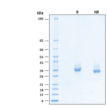 2 μg/lane of Recombinant Human Chondrolectin His-tag Protein (Catalog # 11059-CL) was resolved with SDS-PAGE under reducing (R) and non-reducing (NR) conditions and visualized by Coomassie® Blue staining, showing bands at 34-40 kDa.