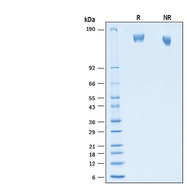 2 μg/lane of Recombinant SARS-CoV-2 AY.4.2 Spike (GCN4-IZ) His-tag Protein (Catalog # 11065-CV) was resolved with SDS-PAGE under reducing (R) and non-reducing (NR) conditions and visualized by Coomassie® Blue staining, showing bands at 145-165 kDa.